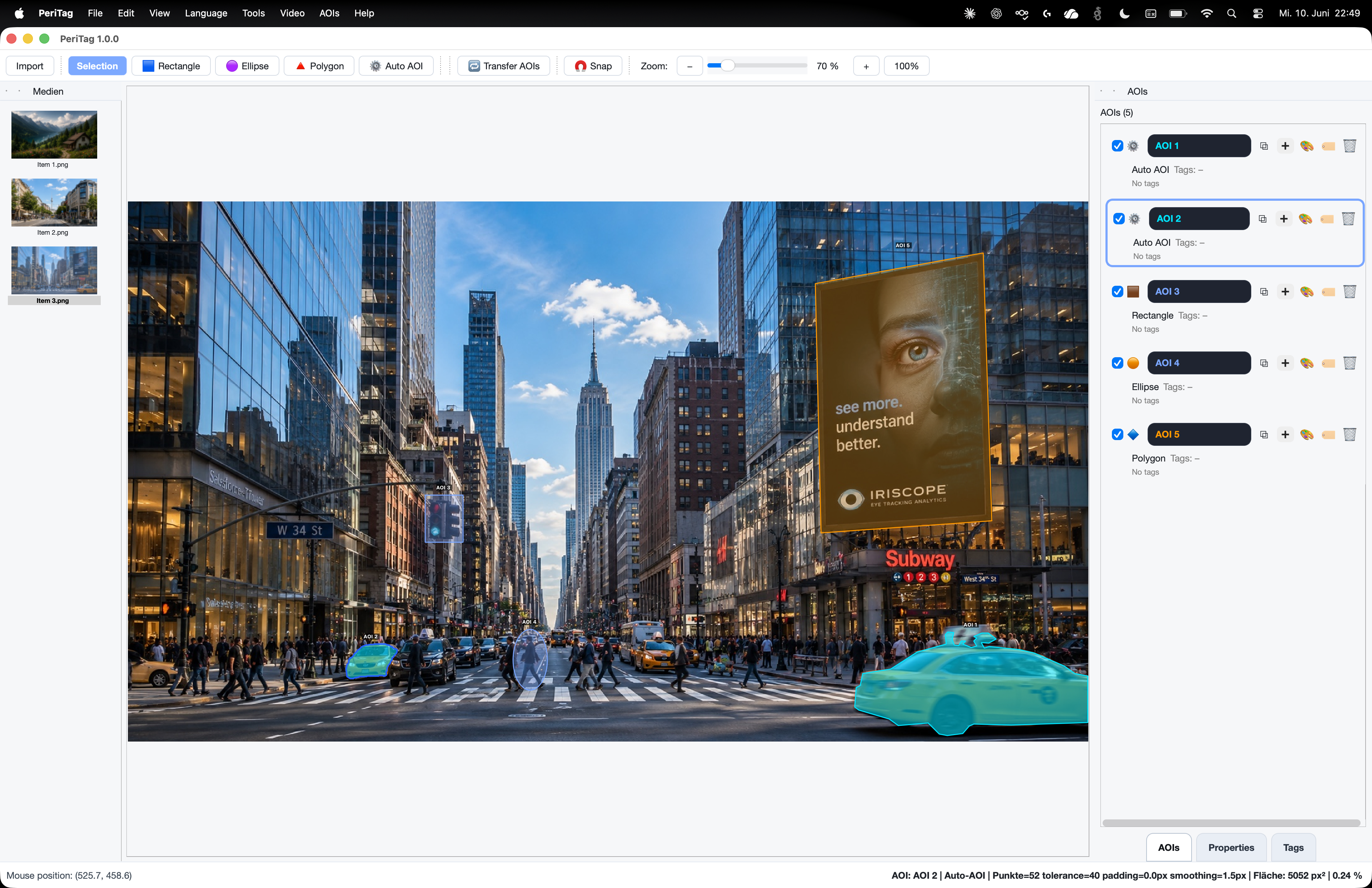PeriTag image annotation workspace with multiple AOIs
